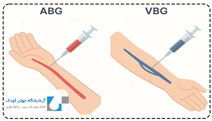 تفسیر abg و vbg