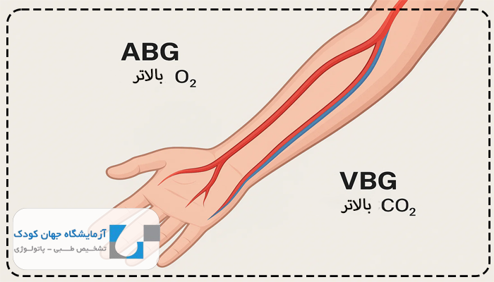 تفسیر آزمایش vbg