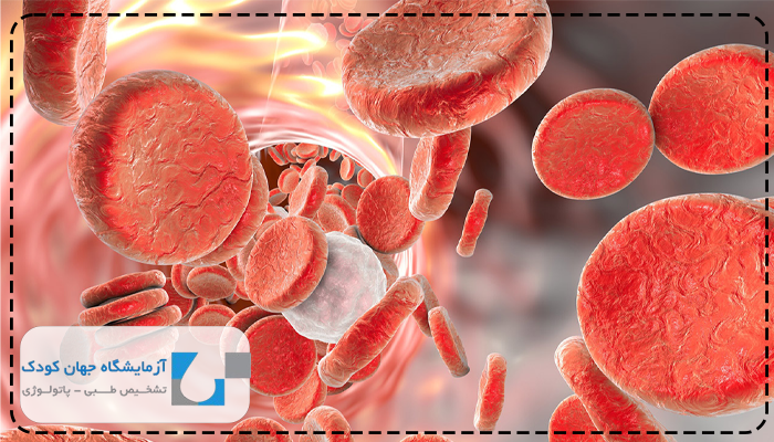 تفسیر آزمایش vbg