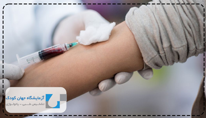 خواب قبل از آزمایش تیروئید