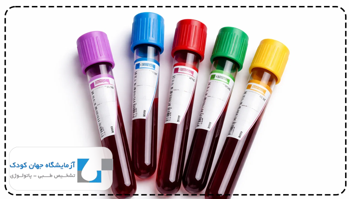 علائم بالا بودن گلبول سفید