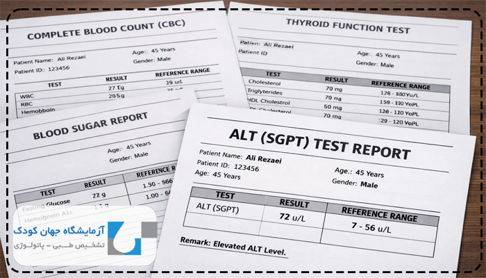 علت بالا بودن alt در آزمایش خون