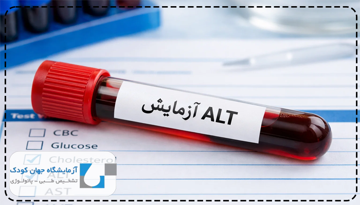 میزان نرمال alt در آزمایش خون