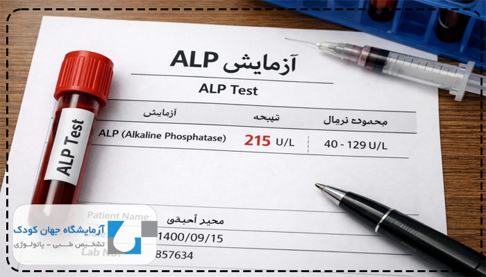 میزان نرمال آلکالین فسفاتاز در بزرگسالان