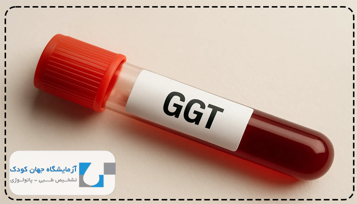 میزان نرمال گاما جی تی