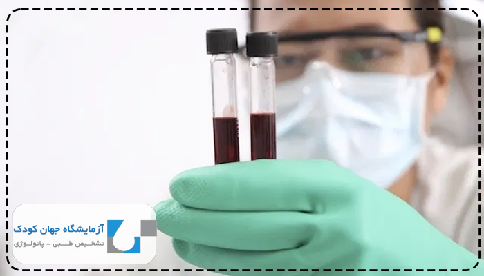 نحوه گرفتن آزمایش vbg