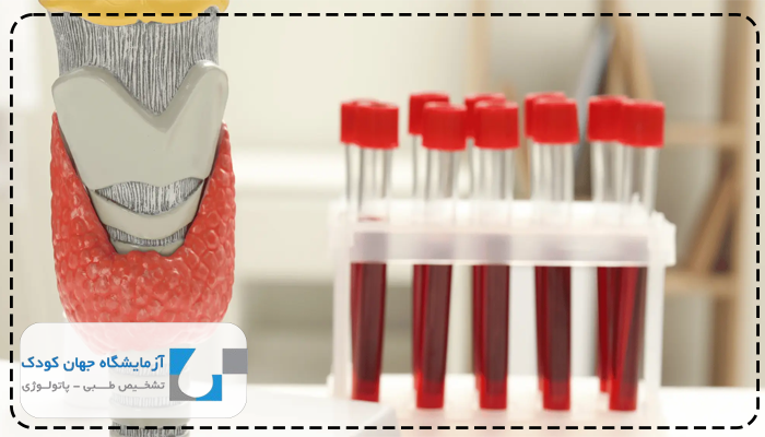 چند ساعت قبل از آزمایش تیروئید باید بیدار باشیم