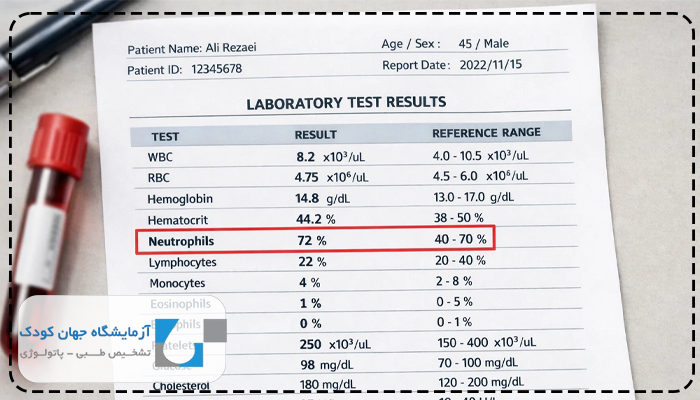 نوتروفیل پایین نشانه چیست